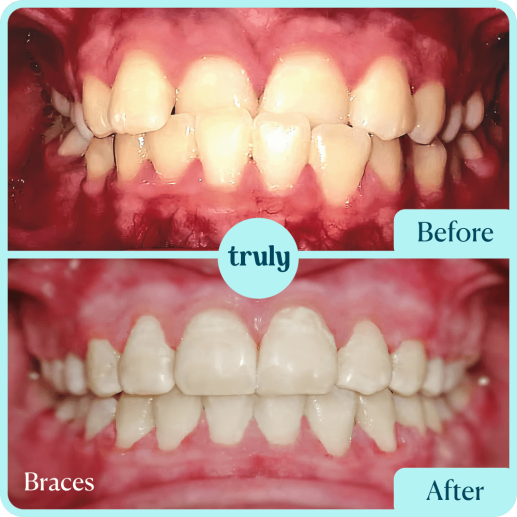Orthodontics