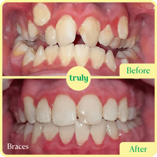 Orthodontics