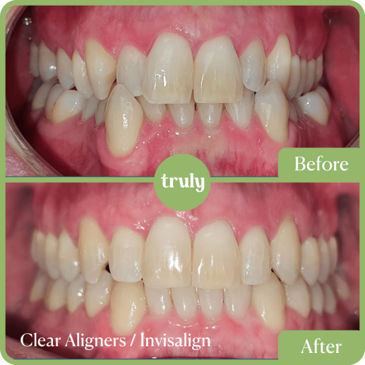 Orthodontics